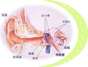 突发性耳鸣怎么治果好？